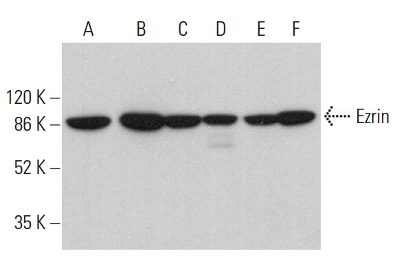 エリンしぃ 27769 Human LRG Assay Kit - IBL (Discontinued : until the