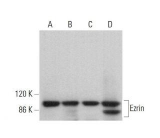 Ezrin Antibody (A-4) - Western Blotting - Image 379859 