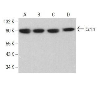 western blotting image from recommended Ezrin (3C12) monoclonal antibody replacement. Image 380451