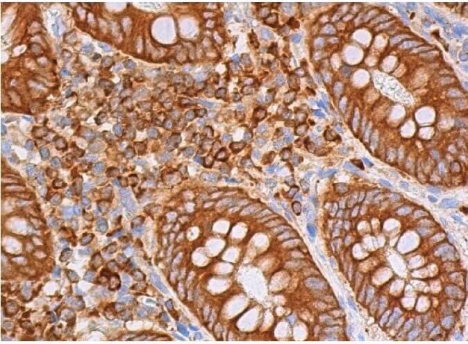Ezrin Antibody (F-1) | SCBT - Santa Cruz Biotechnology