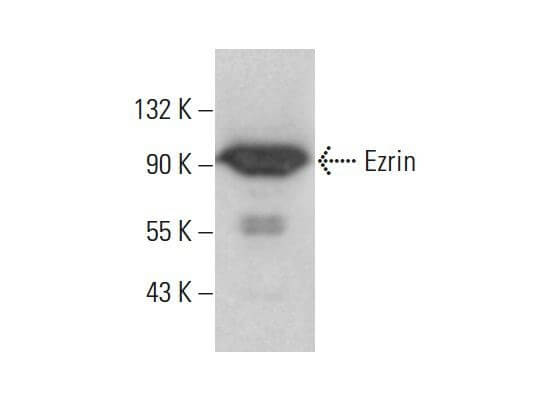Ezrin Antibody (F-1) | SCBT - Santa Cruz Biotechnology