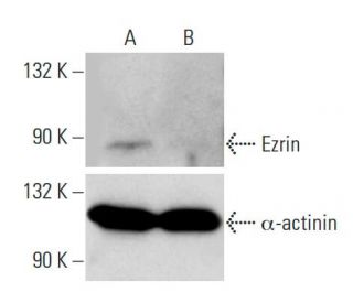 Ezrin siRNA (h): sc-35349. Western blot analysis of Ezrin expression in non-transfected control (A) and Ezrin siRNA transf 