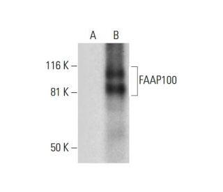 FAAP100 Antibody (C-11) - Western Blotting - Image 291998