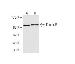 Factor B Antibody (28A3) - Western Blotting - Image 62814