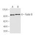 Factor B Antibody (28A3) - Western Blotting - Image 62814