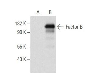 Factor B Antibody (9B6) - Western Blotting - Image 59959 