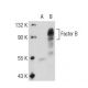 Factor B Antibody (9B6) - Western Blotting - Image 110086 