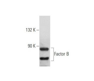 Factor B Antibody (9B6) - Western Blotting - Image 130584 