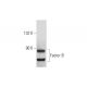 Factor B Antibody (9B6) - Western Blotting - Image 130584 