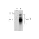 Factor B Antibody (F-7) - Western Blotting - Image 135438
