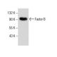 Factor B Antibody (F-7) - Western Blotting - Image 285973 