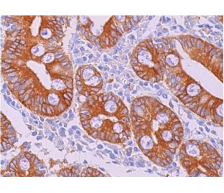 immunohistochemistry image from recommended Factor B (D22/3) monoclonal antibody replacement. Image 375786
