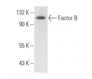 Factor B Antibody (M13/12) - Western Blotting - Image 11031