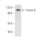 Factor B Antibody (M13/12) - Western Blotting - Image 11031