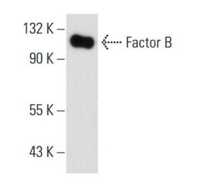 Factor B Antibody (M20/6) - Western Blotting - Image 11029