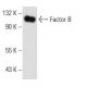 Factor B Antibody (M20/6) - Western Blotting - Image 11029