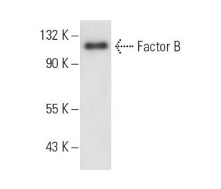 Factor B Antibody (P21/15) - Western Blotting - Image 11030