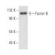 Factor B Antibody (P21/15) - Western Blotting - Image 11030