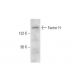Factor H Antibody (D-8) - Western Blotting - Image 303816