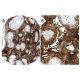 Factor H Antibody (L20/3) - Immunohistochemistry - Image 31572