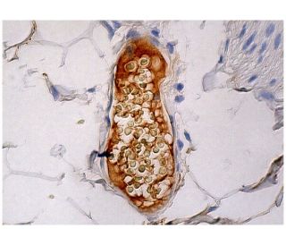 Factor H Antibody (L20/3) - Immunohistochemistry - Image 263039 