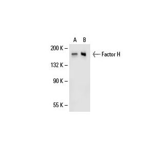 Factor H Antibody (C18/3) - Western Blotting - Image 20455