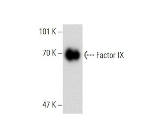 Factor IX Antibody (13B9) - Western Blotting - Image 138629