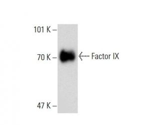 Factor IX Antibody (AHIX-5041) - Western Blotting - Image 138631