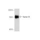 Factor IX Antibody (AHIX-5041) - Western Blotting - Image 138631