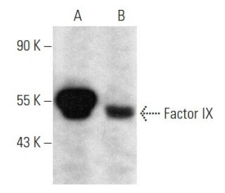 Factor IX Antibody (B-3) - Western Blotting - Image 358416 