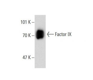 Factor IX Antibody (F9-1) - Western Blotting - Image 138632
