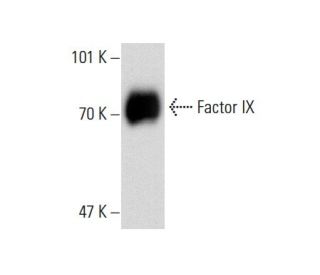 Factor IX Antibody (GMA-138) - Western Blotting - Image 138634