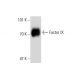 Factor IX Antibody (GMA-138) - Western Blotting - Image 138634