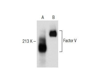 Factor V Antibody (6A5) - Western Blotting - Image 150247