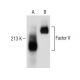 Factor V Antibody (6A5) - Western Blotting - Image 150247