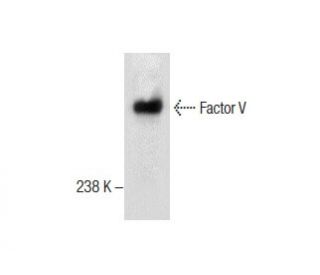 Factor V Antibody (A-2) - Western Blotting - Image 287201