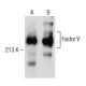 Factor V Antibody (AHV-5110) - Western Blotting - Image 150249