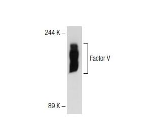 Factor V Antibody (GMA-044) - Western Blotting - Image 72738