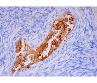 Factor VII Antibody (CaFVII-22) - Immunohistochemistry - Image 293360