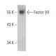 Factor VII Antibody (RFF-VII/2) - Western Blotting - Image 387370