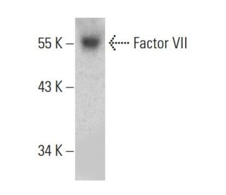Factor VII Antibody (RFF-VII/2) - Western Blotting - Image 387370The Double Nickase Plasmid features a U6 promoter for sgRNA expression, a 20 nt targeting sequence, and a gRNA scaffold to guide Cas9n. It includes a CBh promoter for Cas9n (D10A) and puromycin resistance, GFP for transfection verification, and nuclear localization signals (NLS). The 2A peptide allows co-expression of Cas9n and Puro from a single promoter, enabling precise genome editing with reduced off-target effects.
