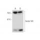 Factor VIII Antibody (102) - Western Blotting - Image 138623