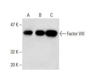 Factor VIII Antibody (GMA-012) - Western Blotting - Image 138624 