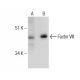 Factor VIII Antibody (GMA-012) - Western Blotting - Image 281652