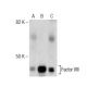 Factor VIII Antibody (GMA-012) - Western Blotting - Image 281719 