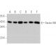 western blotting image from recommended Factor VIII (R8B12) monoclonal antibody replacement. Image 368228