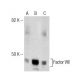 Factor VIII Antibody (R8B12) - Western Blotting - Image 281718