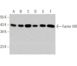 Factor VIII Antibody (R8B12) - Western Blotting - Image 368228