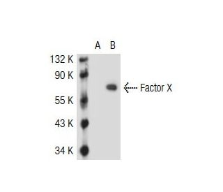 Factor X Antibody (AHX-5050) - Western Blotting - Image 36821