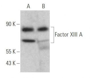 Factor XIII A Antibody (B-8) - Western Blotting - Image 358991 
